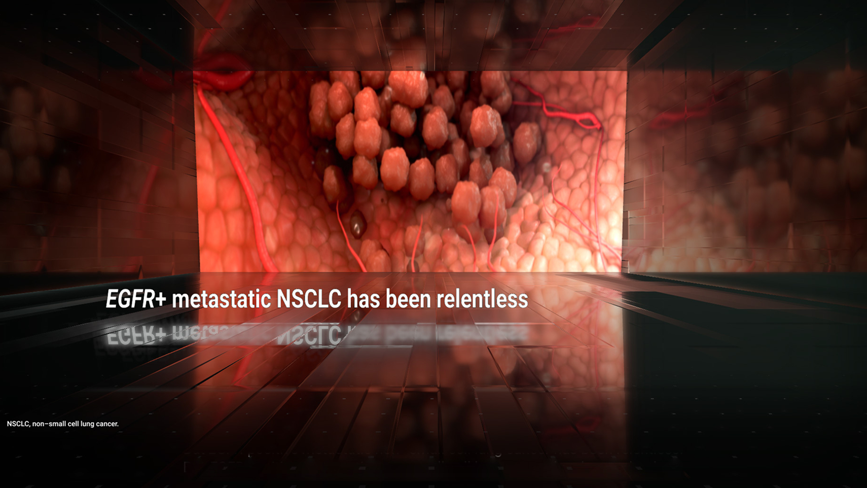 A First-Line Treatment Option for Patients With Locally Advanced or Metastatic Non-Small Cell Lung Cancer With EGFR Exon 20 Insertion Mutations with Mark Socinski, MD video